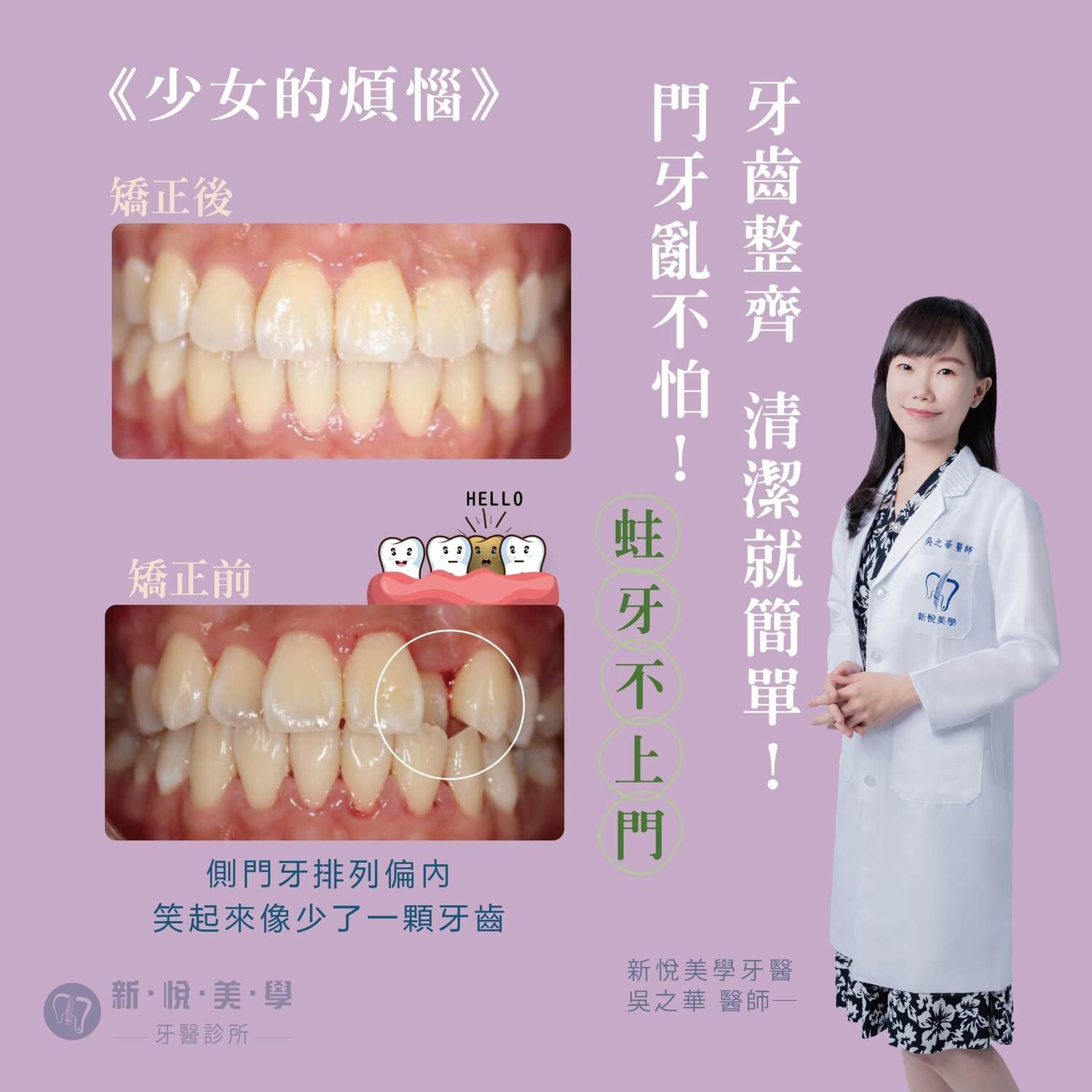 新悅美學牙醫診所的案例分享圖片